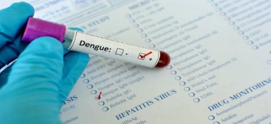 How to Know about Dengue Virus Research in the Singapore Region